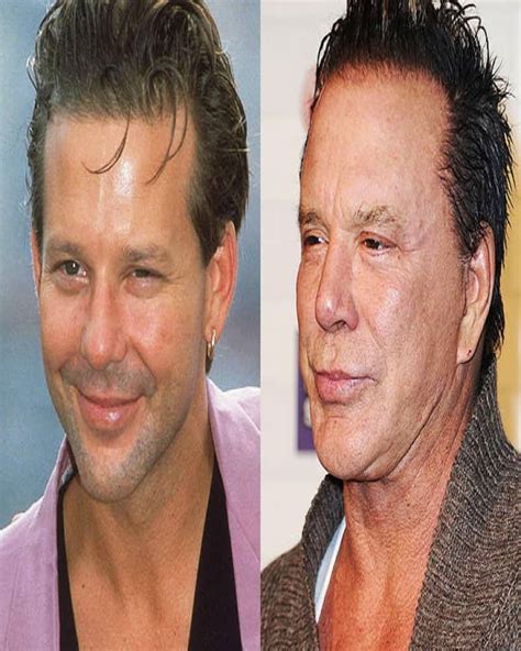 20 Of The Worst Celebrity Plastic Surgery Disasters