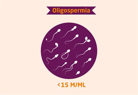 Oligospermia: Symptoms, Causes & Treatment