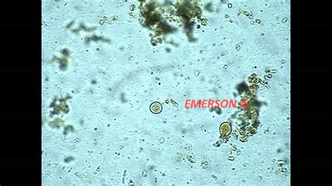 Entamoeba Coli Under Microscope