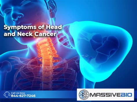 Symptoms of Head and Neck Cancer