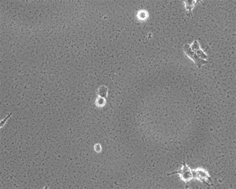 Mycoplasma Contamination In Cell Culture