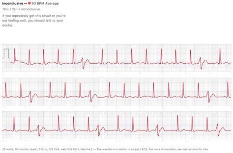 My mother has been having a fast heartbeat for the last couple of days ...