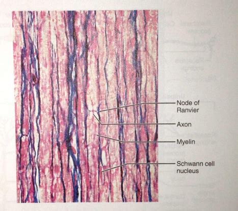 Exercise 17 - Histology of nervous tissue Flashcards | Quizlet