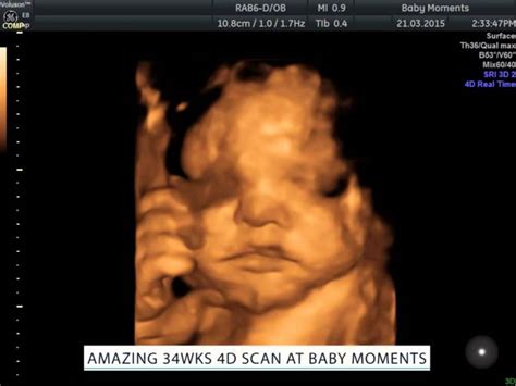 Amazing 4D baby scan - YouTube