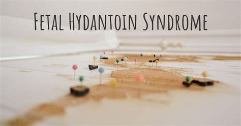 Join the map of Fetal Hydantoin Syndrome