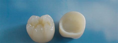 Zirconia Crowns