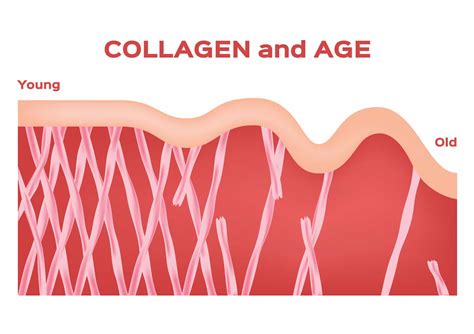 Collagen As We Age: Role, Signs, Procedures, Products, and Preventative ...