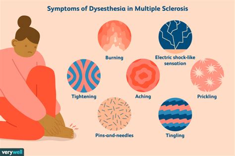 Dysesthesia in MS: Symptoms, Causes, Diagnosis, and Treatment