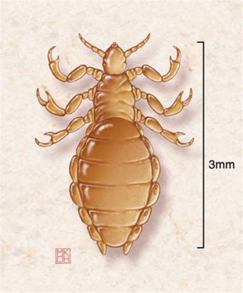 Lice and Scabies: Treatment Update | AAFP