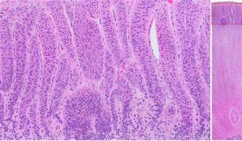 Adrenal gland – Veterinary Histology