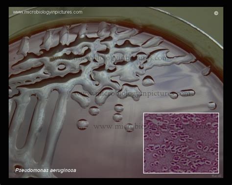 Pseudomonas Aeruginosa In Urine Culture