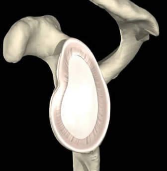 Glenoid Labrum Tear - Bodymotion Spine & Sports Injuries Clinic