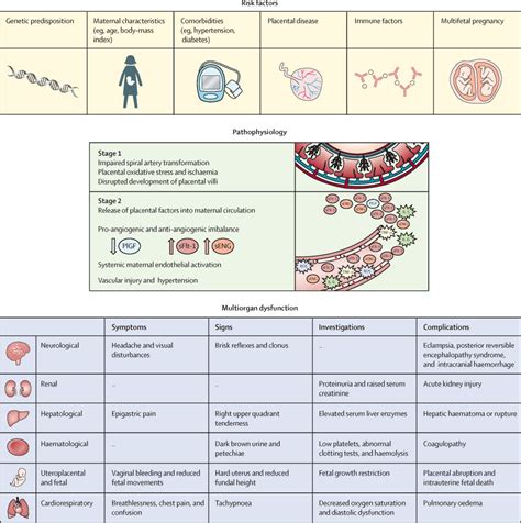 Pre-eclampsia - The Lancet