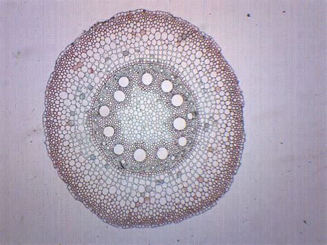 Monocot Stem Under Microscope