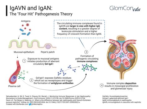 IgA Vasculitis Associated with Nephritis: Mini-Review – GlomCon (pubs)