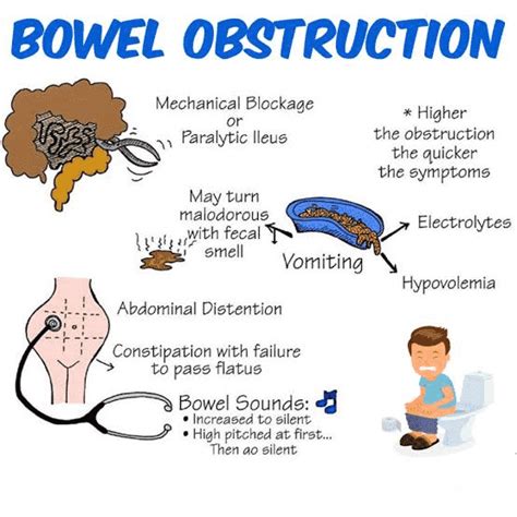 Intestinal Obstruction -Presentation And Treatment