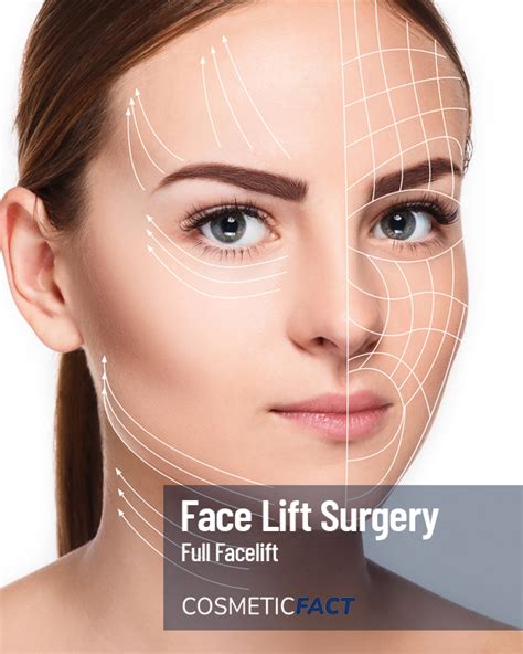 Mini Facelift vs. Full Facelift: Choosing the Right Procedure