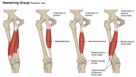 Sports Injury Bulletin - Diagnose & Treat - Acute Hamstring Injury ...