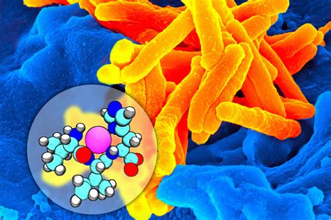 Tuberculosis causes, prevention, vaccine, symptoms, diagnosis & treatment