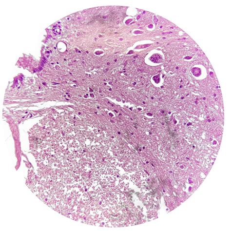 Nerve Tissue | Histology and Histophathology