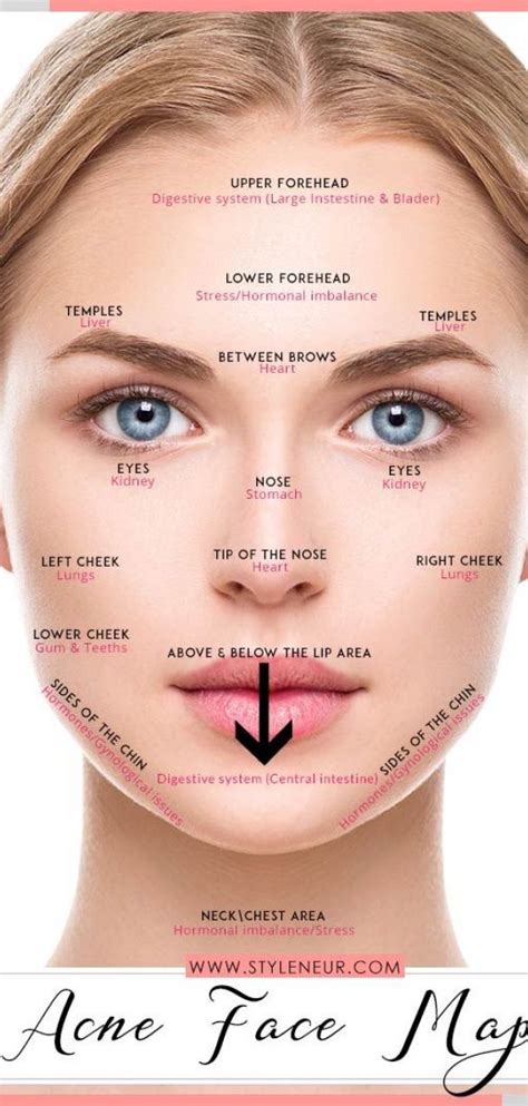 acne chart reasons ~ #acne #chart #reasons | Forehead acne, Face ...