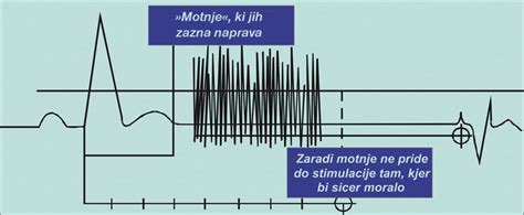 and 2. Examples of electromagnetic interference. | Download Scientific ...