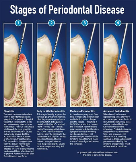 Healthy Gums and Teeth Cleaning | Aliso Viejo Dentist | Cosmetic Dentist