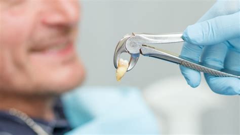 Reduce Bone Loss For Missing Teeth - Sutherland Dental