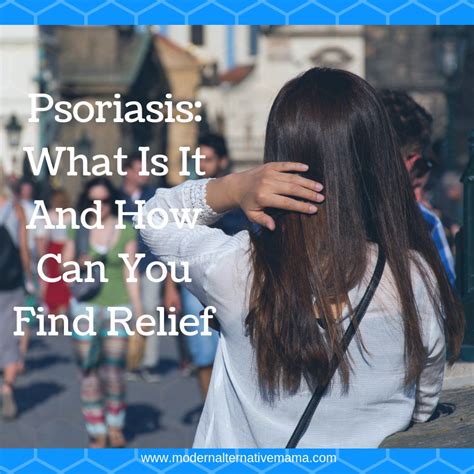 Psoriasis: What Is It And How Can You Find Relief