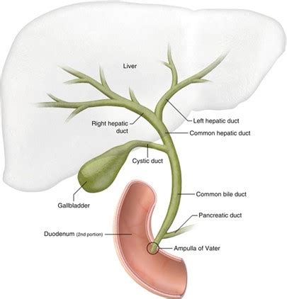 Pediatric Cholecystostomy and Biliary Drain Placement - Conditions and ...