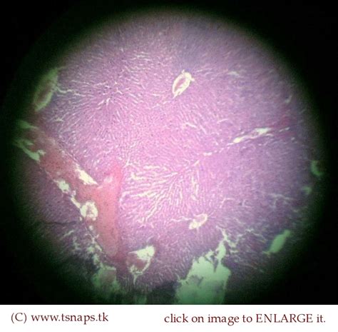 Histology Slides Database: Liver histology slides