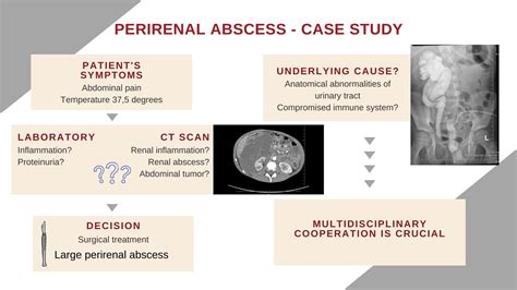 Medicina | Free Full-Text | The Rare Case of Perirenal Abscess in a ...