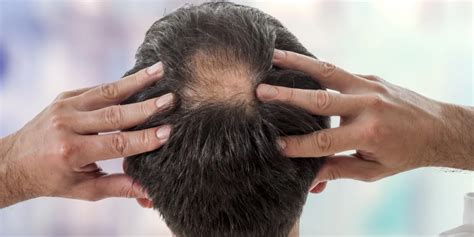 Scalp Massage for Hair Loss: Myth or Reality? | TheMassageRooms