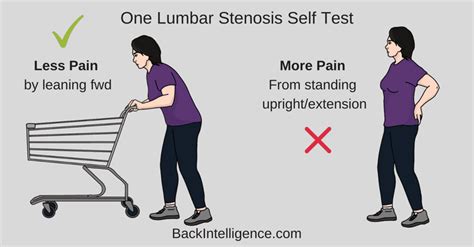 Lumbar Spinal Stenosis DYI Treatment - Symptoms & Exercises