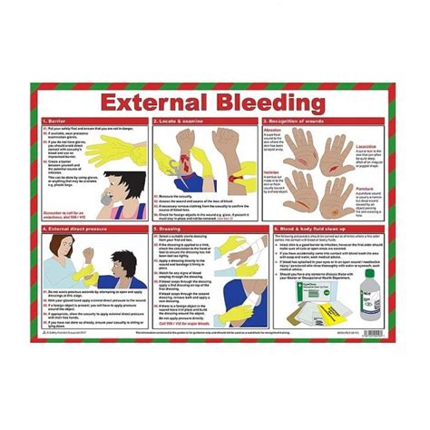 External Bleeding Laminated Poster | Safety Posters - PARRS