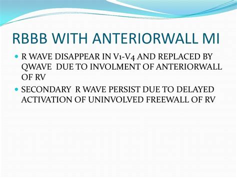 ECG: Bifascicular Block