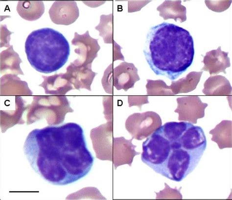 (A) Normal lymphocyte (B) reactive lymphocyte (C and D) atypical ...