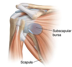 Understanding Subscapular Bursitis | Saint Luke's Health System