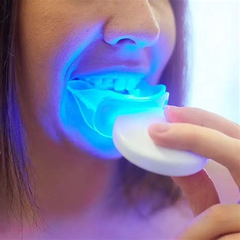 Blanqueamiento dental con luz LED: qué es y cómo funciona