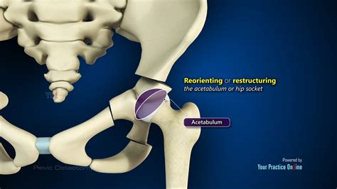 Shoulder Surgery Videos | Your Practice Online Education