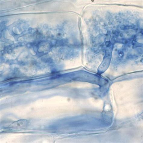 (PDF) The Glomeromycota