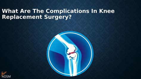 What are the complications in knee replacement surgery? by AOSM Delhi ...