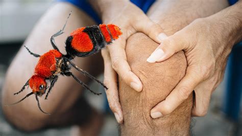 'Cow Killer' Ant Leaves Florida Man With Nasty Bite, 'Excruciating ...