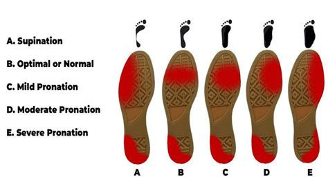 Down and dirty differences between pronation vs supination of foot?