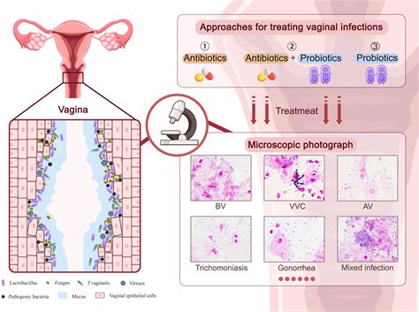 Frontiers | Use of probiotic lactobacilli in the treatment of vaginal ...