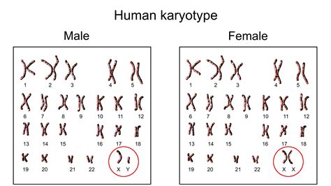 A Human Baby Has Two X Chromosomes Its Sex Is - Tibbs Theence55