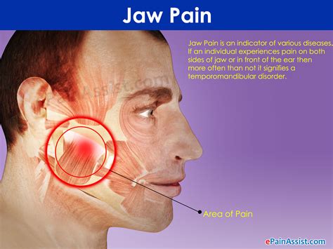 What Causes Your Jawline To Swell | Justinboey