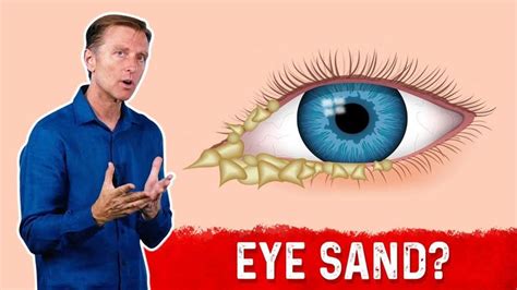 What Causes Crusty Eyes? | Crusty eyes, Doctor of chiropractic, Eyes