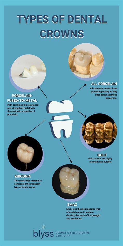 Types of Dental Crowns: Insider Tips to Choose the Best One for You