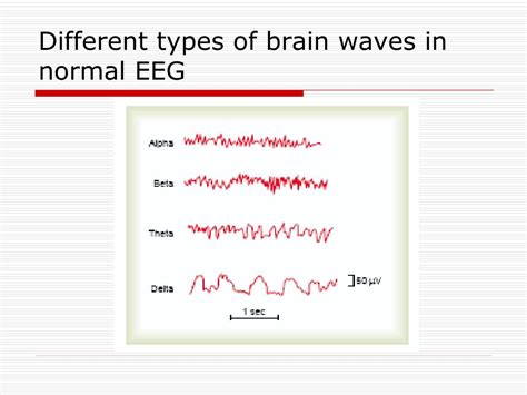 PPT - ELECTROENCEPHALOGRAPHY (EEG) PowerPoint Presentation - ID:297106